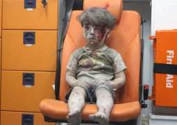 A picture of four years old Syrian wounded boy wounds hearts of people