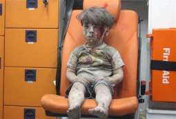 A picture of four years old Syrian wounded boy wounds hearts of people