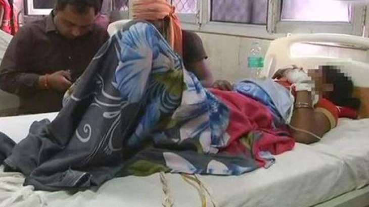 Woman hospitalized after self-immolation attempt Faisalabad 