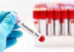 Grooms required undergoing Thalassemia test before marriage
