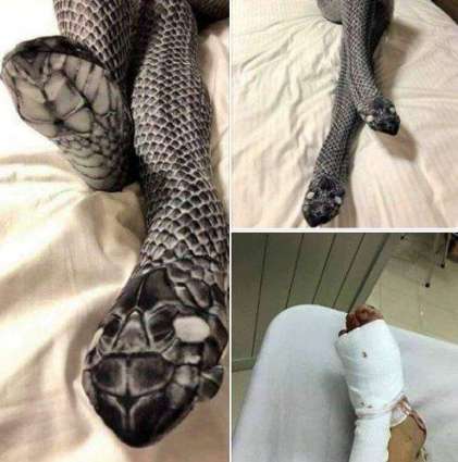 Woman wears ‘Snake looking’ stockings; husband beats her mistaking it for two real snakes