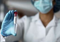 Russian-Made Ebola Vaccine Ready to Be Distributed for Use - Official