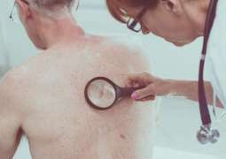 Laser probe detects deadly melanoma in seconds