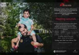 "شفاء الجروح" أول معرض فوتوغرافي لـ "أطباء بلا حدود" في الإمارات