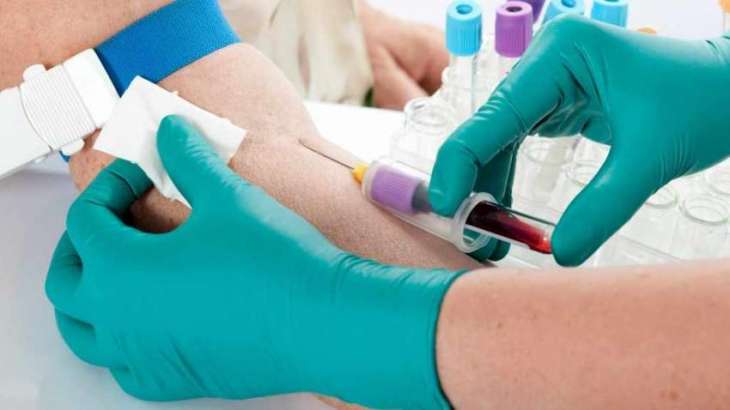 Blood test may predict cardiovascular disease