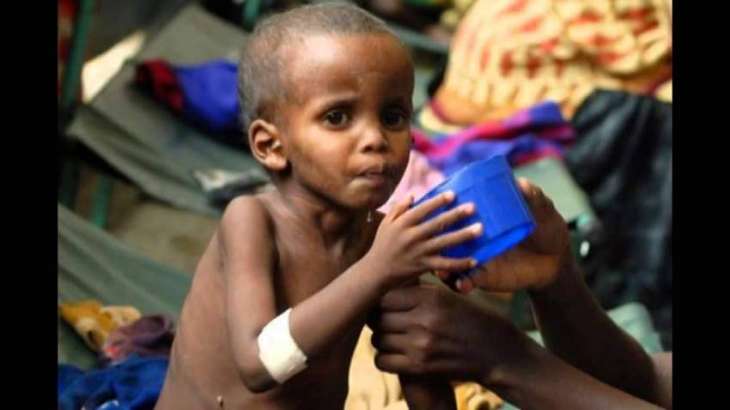 Nutrition Problems of Children Hindering Nation's Growth  Says Experts