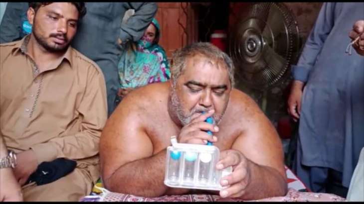 330kg obese man Noor Hassan to undergo surgery in Lahore