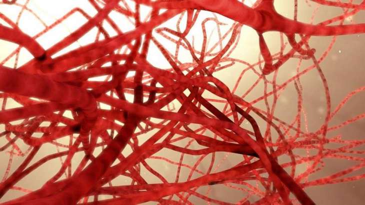Could bone-like particles in blood contribute to artery clogging?