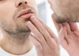 How dormant herpes springs back to life
