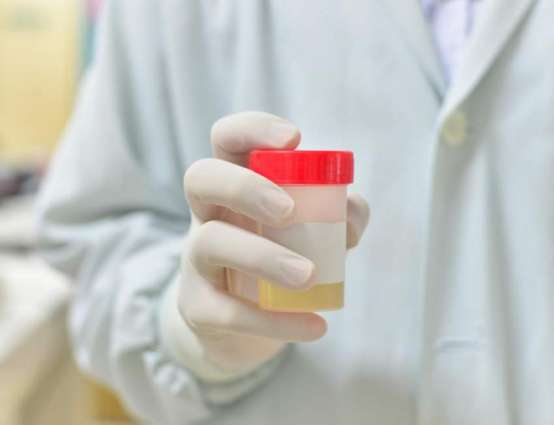 Prostate cancer: Home urine test could 'revolutionize diagnosis'