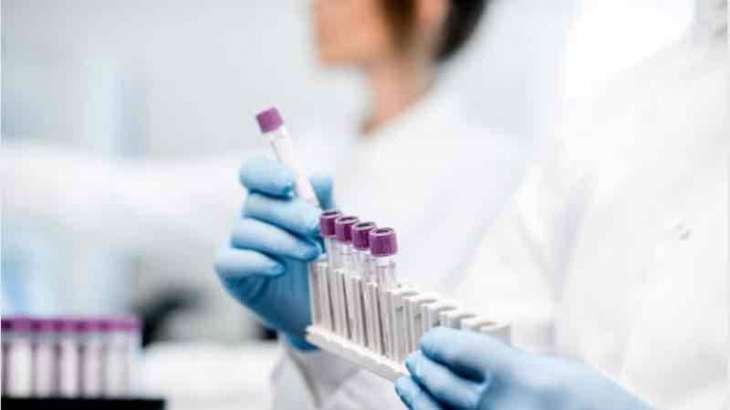 Medical Company Novacyt Rolls Out New Strain-Specific Coronavirus Test