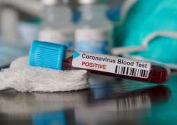 Africa Needs Test Kits as Early COVID-19 Detection Key to Prevent Spread - NGO