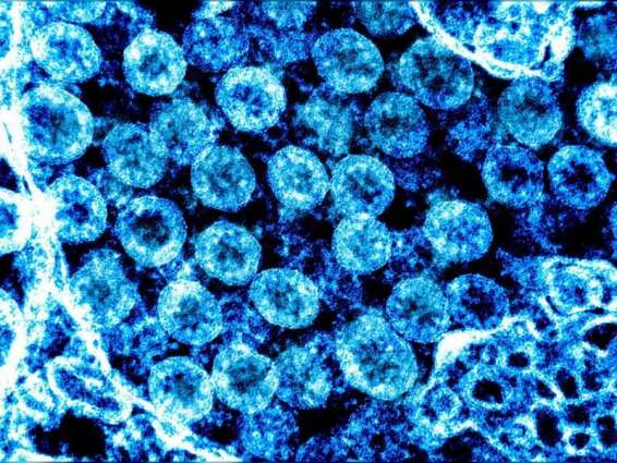 Coronavirus claims its first UN casualty