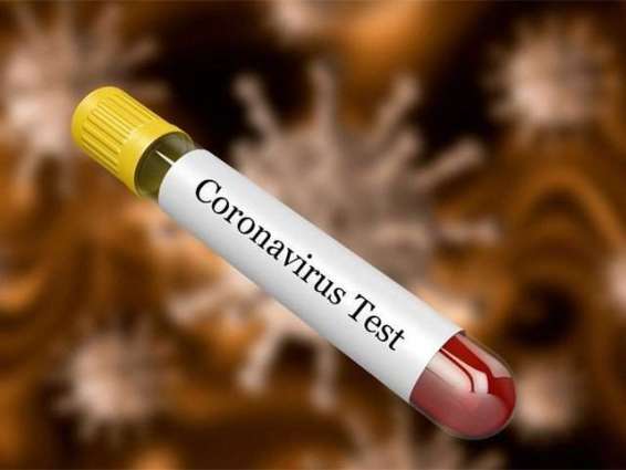 Why Coronavirus test is not tax free in Pakistan?