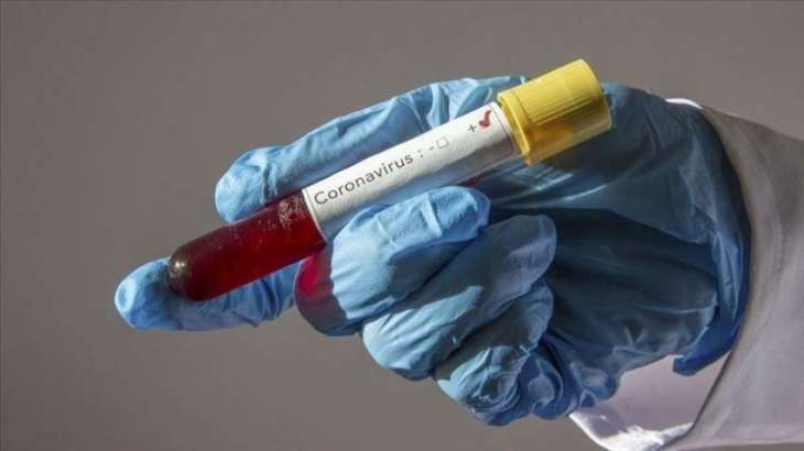 Number of Coronavirus Cases in Afghanistan Rises to 245 - Health Ministry