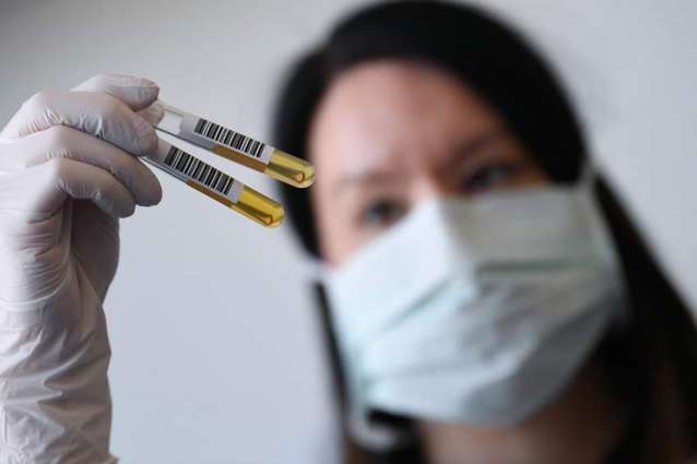 German Labs Ramp Up Coronavirus Testing Capacity to 100,000 Per Day - Association