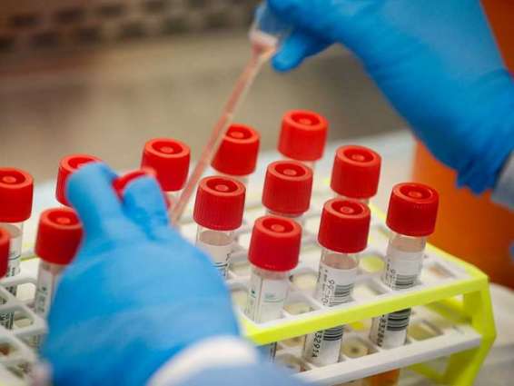 Dubai announces UAE’s first full genome sequencing of the COVID-19 virus