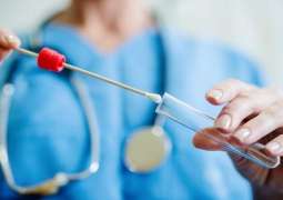 WHO Calls on Egypt to Ramp Up Coronavirus Testing - Regional Director