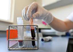 RDIF, Italian Partners Working on Blood Plasma Treatment for Coronavirus in Russia