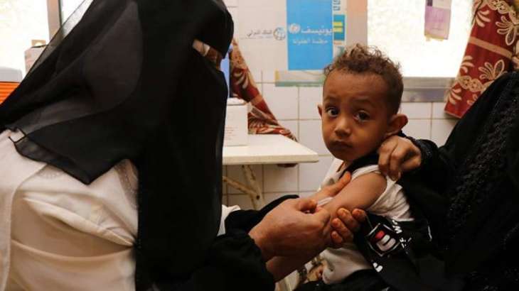 COVID-19 Pandemic May Increase Child Malnutrition Rate in Yemen - WFP Spokesperson