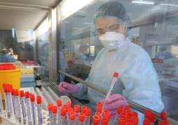 Russian Experts Working on COVID-19 Vaccine in Form of Dairy Product - Academy of Sciences