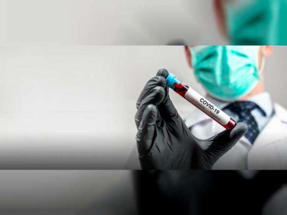 Worldwide coronavirus cases cross 8.18 million, death toll at 440,954