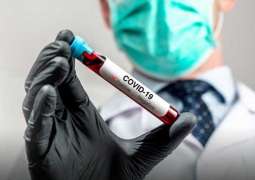 أكثر من 1.024 مليون وفاة في العالم جراء فيروس "كورونا"