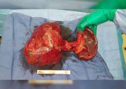 Cleveland Clinic Doctors remove cancerous mass weight of 3.5kg from patient’s pancreas