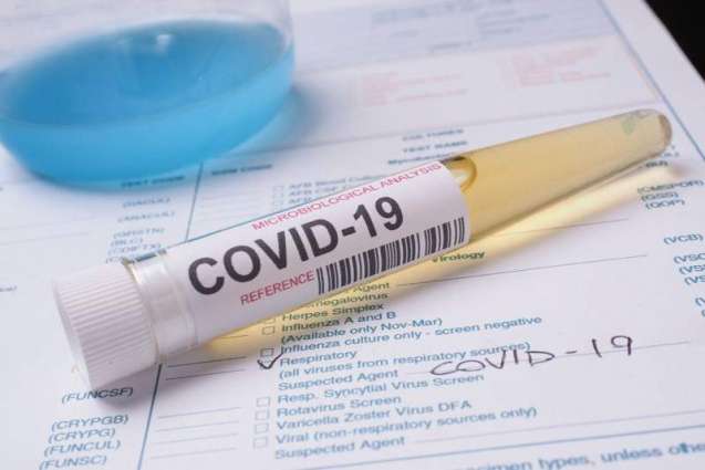 California Becomes Second State in US With Over 1Mln COVID-19 Cases
