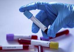 Russia's Siberia, Ural Have Over 50% Positive COVID-19 Antibody Tests Every Day - Company