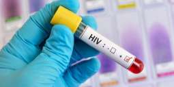 Australia Terminates Deal to Buy Domestic Vaccine Over False Positive HIV Tests - Reports