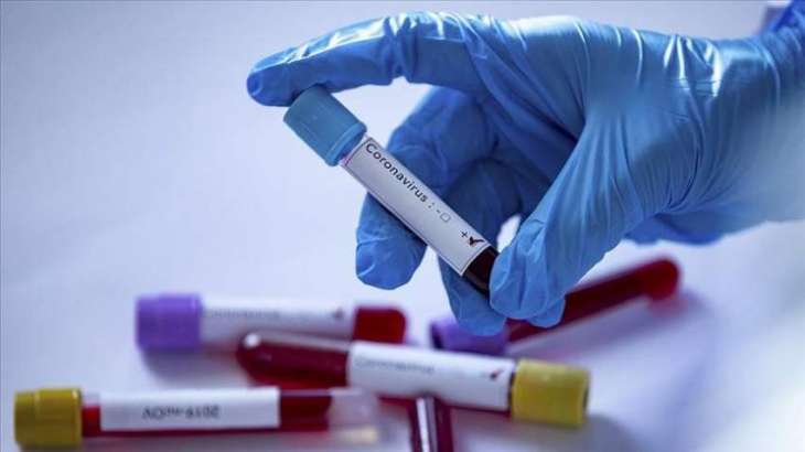 Chief of Russian Accounts Chamber Tests Positive for Coronavirus