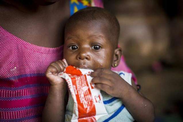UNICEF Warns Over 10Mln Children in 7 Countries May Face Acute Malnutrition in 2021