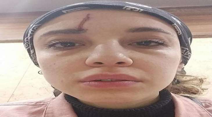 فتاة مصریة تتعرض للتحرش و التعذیب علی ید الشبان أثناء سیرھا بأحد شوارع الاسکندریة