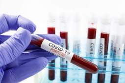 Over 10 Million Russians Fully Vaccinated Against COVID-19 - Watchdog