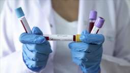 France to Drop PCR Test for Vaccinated Tourists From EU, S.Korea, Australia, Israel on Wed