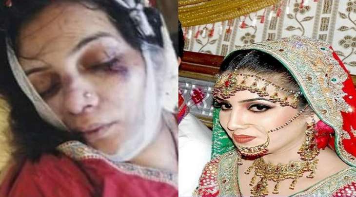 القبض علی زوج بتھمة قتل زوجتہ بعد الاعتداء علیھا بالضرب في مدینة حیدرآباد