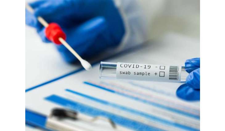 Study confirms effectiveness of mass testing in containing COVID-19 in UAE