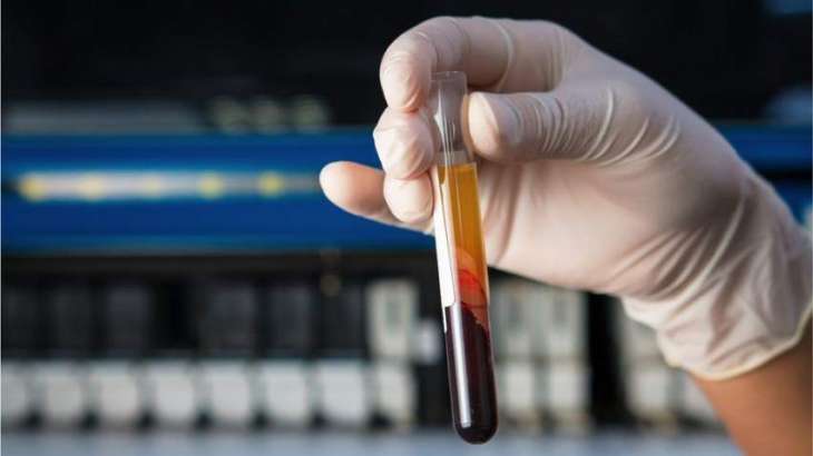 UK Doctors Told to Ration Blood Tests Because of Collection Tube Shortage - Reports