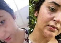 صیدلانیة تتعرض للاعتداء بالضرب فی محافطة الشرقیة بمصر