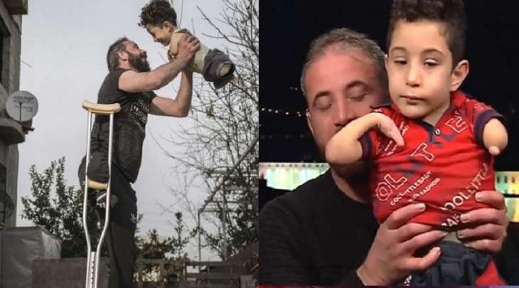صورة لأب سوري بساق و طفلہ دون أطراف تفوز بجائزة صورة العالم 2021م