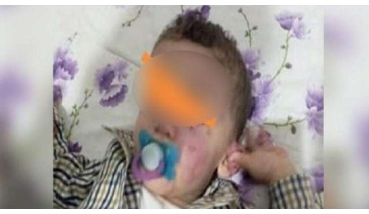 طفل تونسي یتعرض للعنف الشدید باحدی ریاض الأطفال بمحافظة القیروان