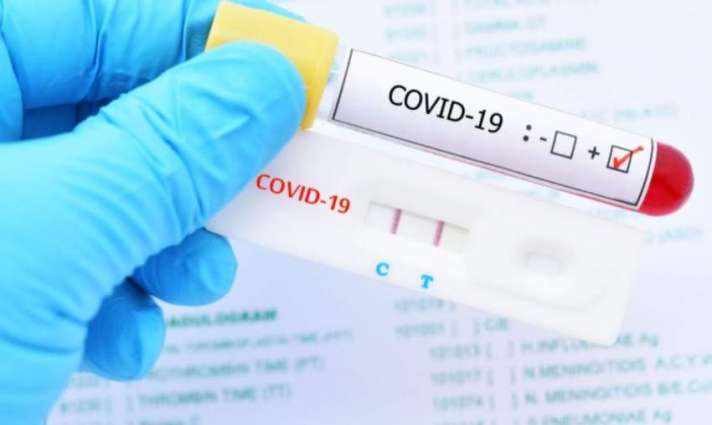Greece Will Require Negative COVID-19 Test Done Within 72 Hours From Travelers