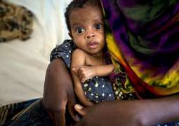 Nearly Half of Children in Somalia's South Suffer Chronic Malnutrition - NGO