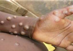 Monkeypox Outbreak Can Still Be Contained, Risk of Transmission Low - WHO