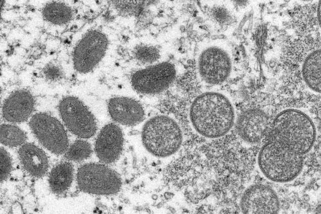 California Public Health Officials Report First Suspected Case of Monkeypox