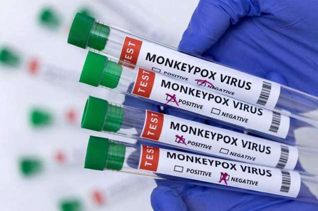 UK Health Security Agency Detects 71 New Cases of Monkeypox - Reports
