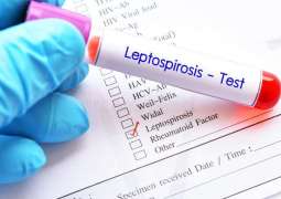 Tanzanian Health Ministry Identifies Unknown Disease Killing 3 as Leptospirosis - Reports