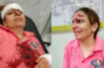 امرأۃ مصریۃ تتعرض للاعتداء بالضرب من زوج شقيقتها