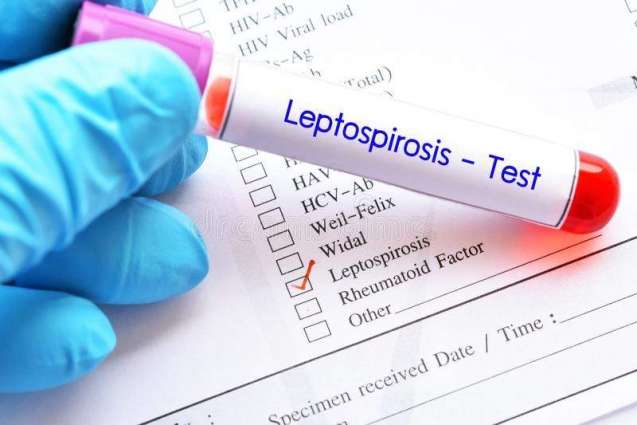 Tanzanian Health Ministry Identifies Unknown Disease Killing 3 as Leptospirosis - Reports